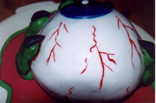 Eyeball 2